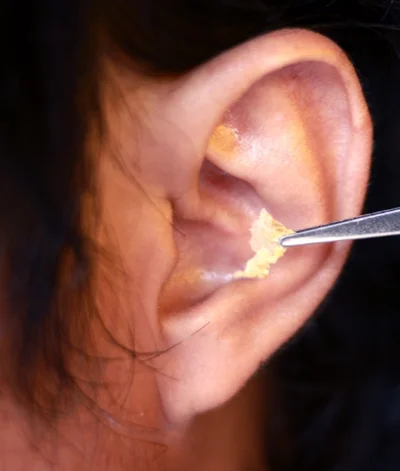 What is earwax